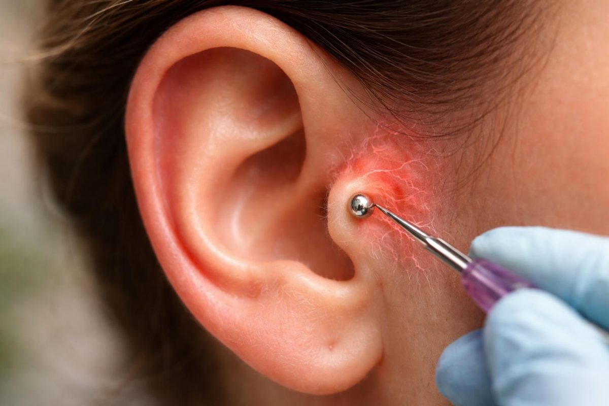 découvrez les risques de paralysie liés au piercing tragus, les précautions à prendre et les conseils pour un perçage sécurisé.